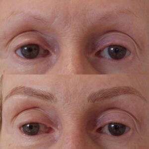 microblading eyebrows hair loss