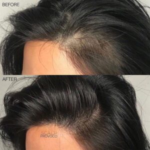female scalp micropigmentation by sian dellar clinic