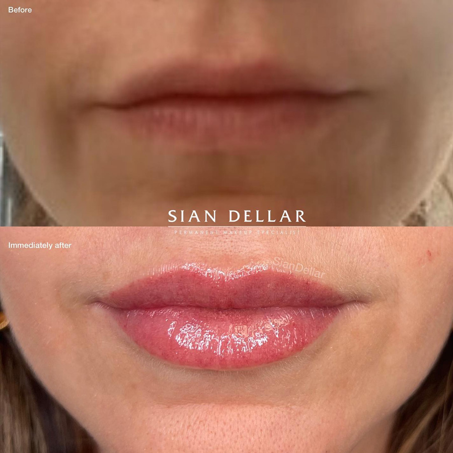 lip blush before after sian dellar