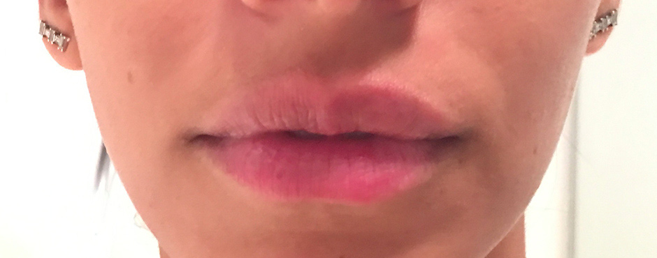 lip blush before tint 1