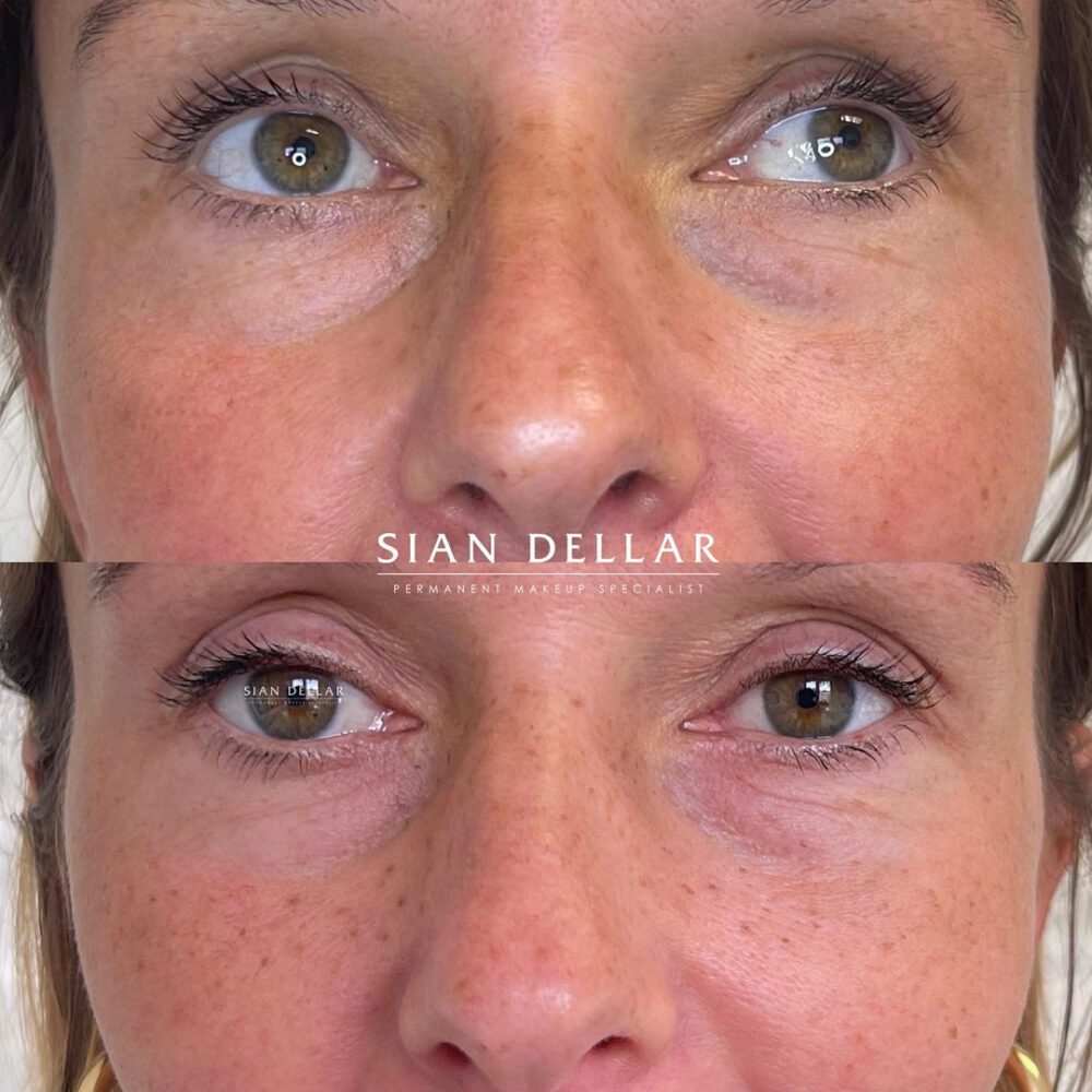 Freckles with permanent makeup