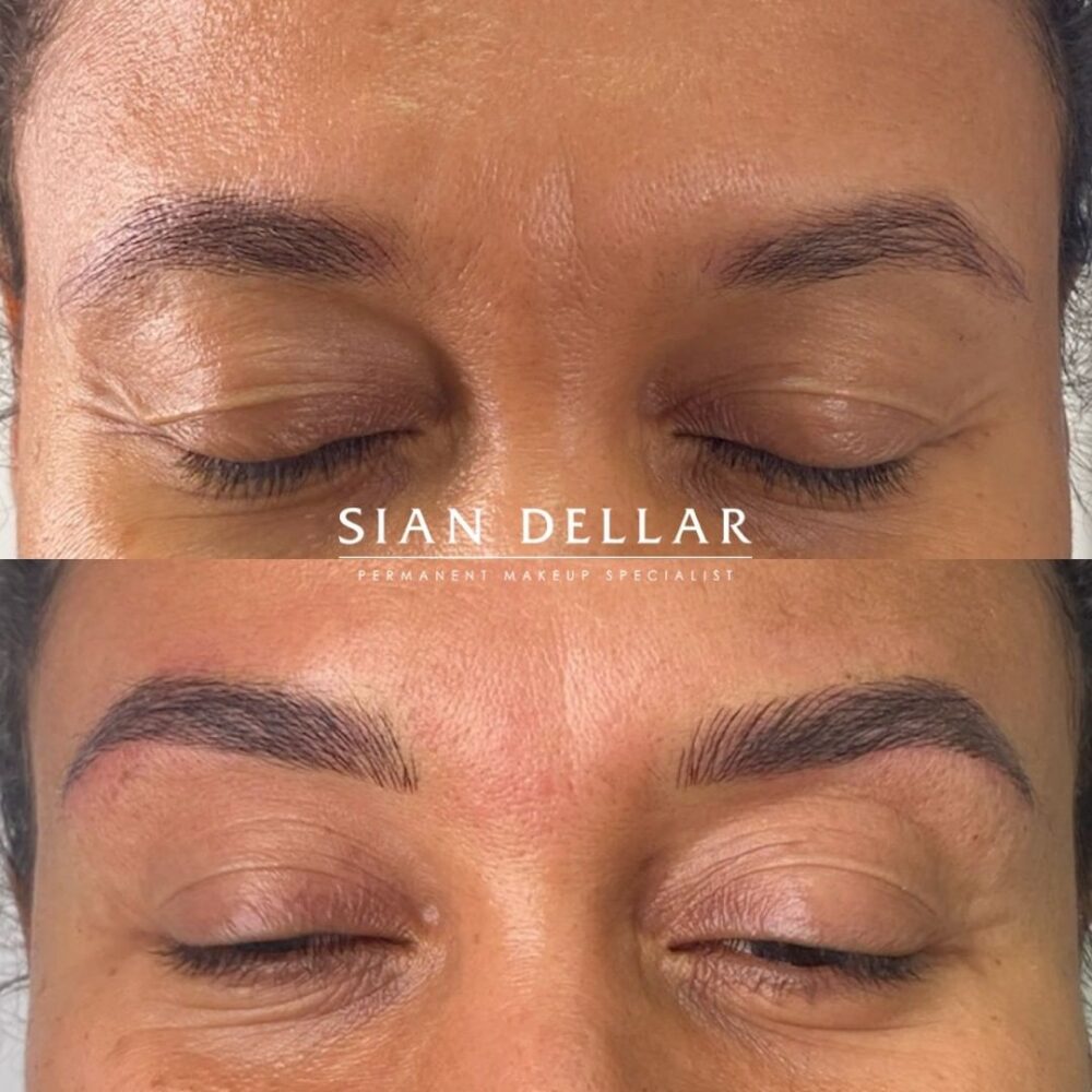 Eyebrow enhancement with microblading