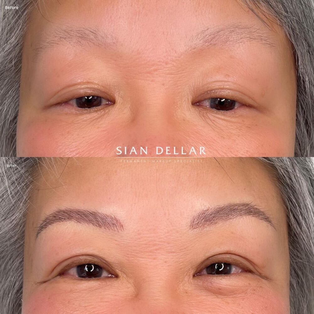 Microblading for thinning eyebrows