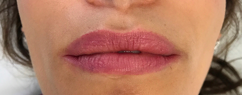 lip blush 1 after