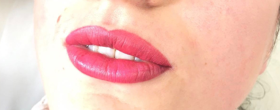lip blush 5 after