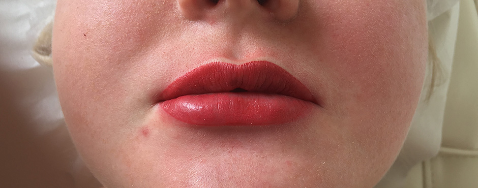 lip blush 6 after