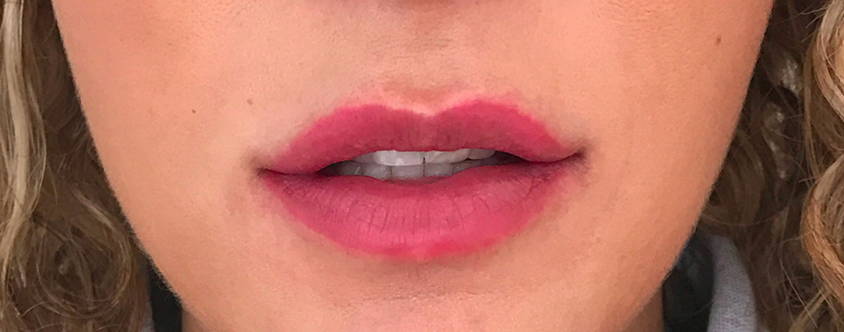 lip blush 7 after