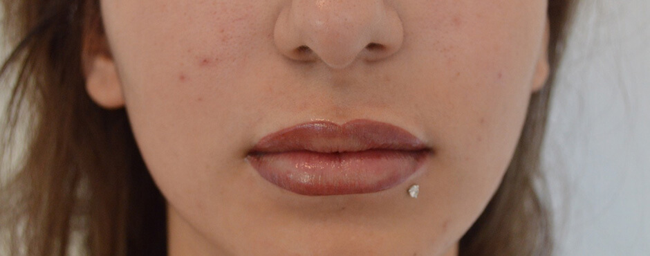 lip blush 9 after