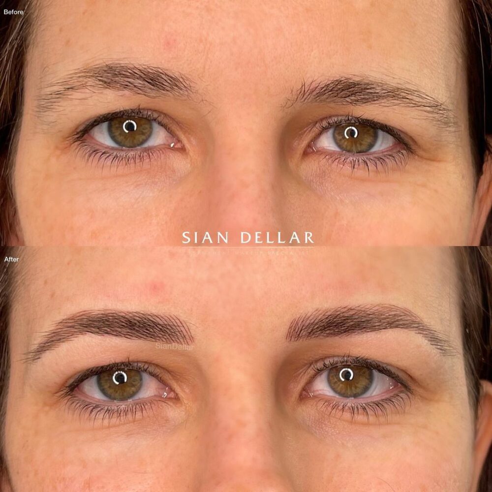 Creating neat medium arch eyebrows with microblading