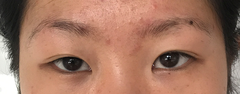 portfolio microblading eyebrows 9 before