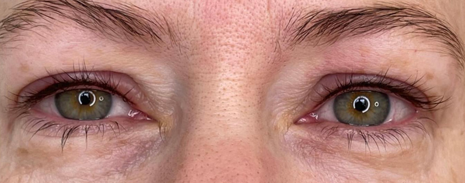 thin permanent eyeliner on top eyelid after