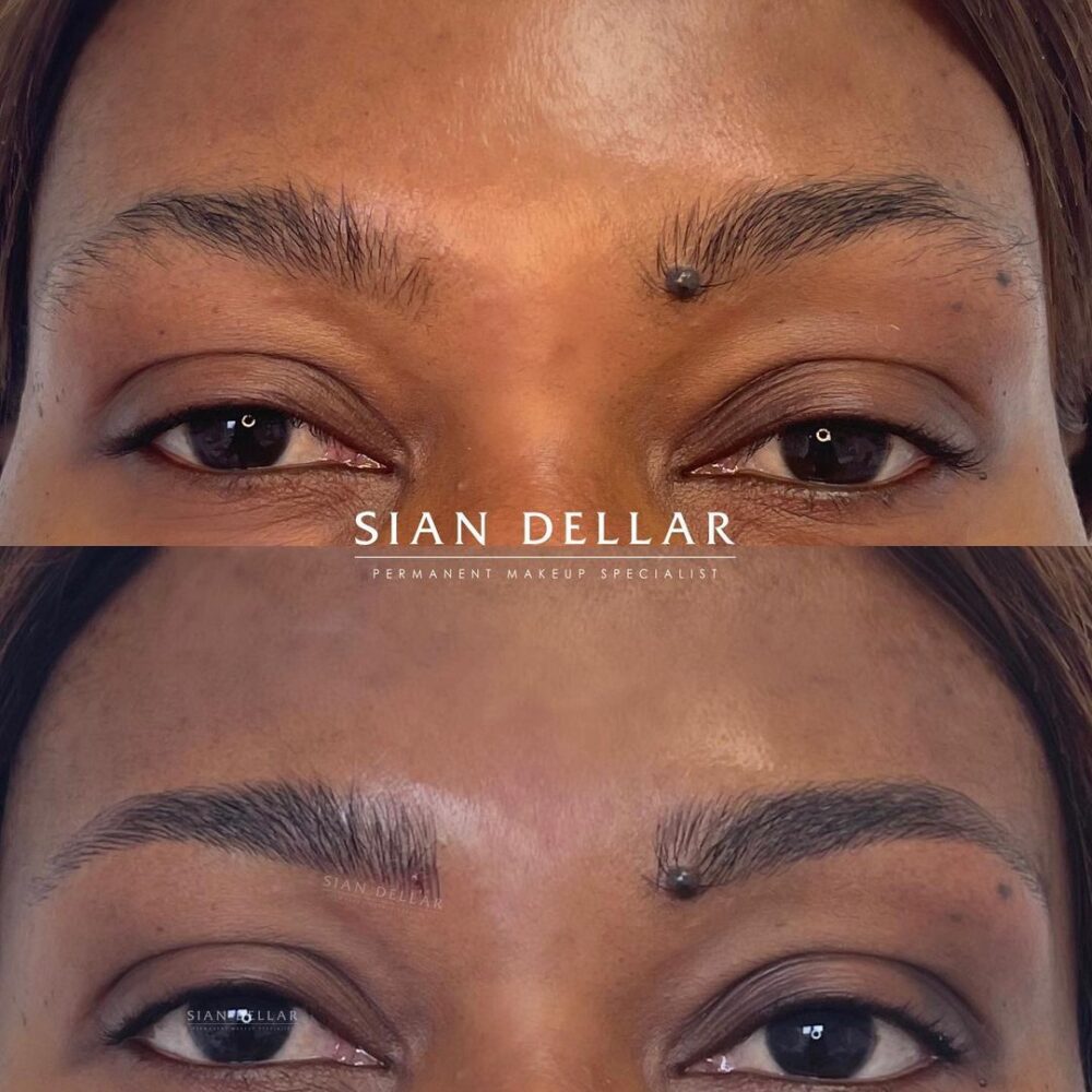 Taming unruly brows with microblading