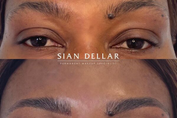 Taming unruly brows with microblading