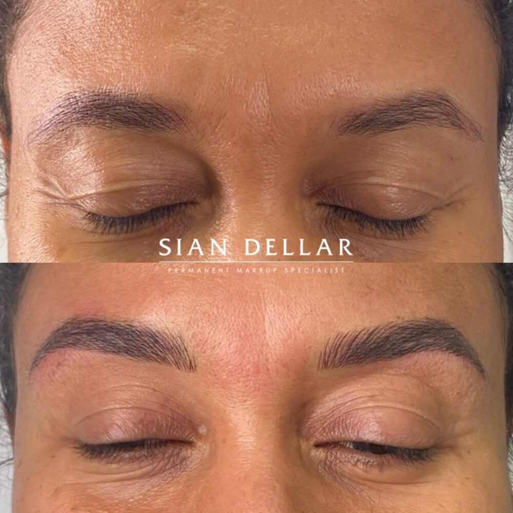 Brow definition with microblading