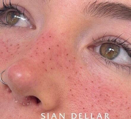 Faux freckles just in time for the summer
