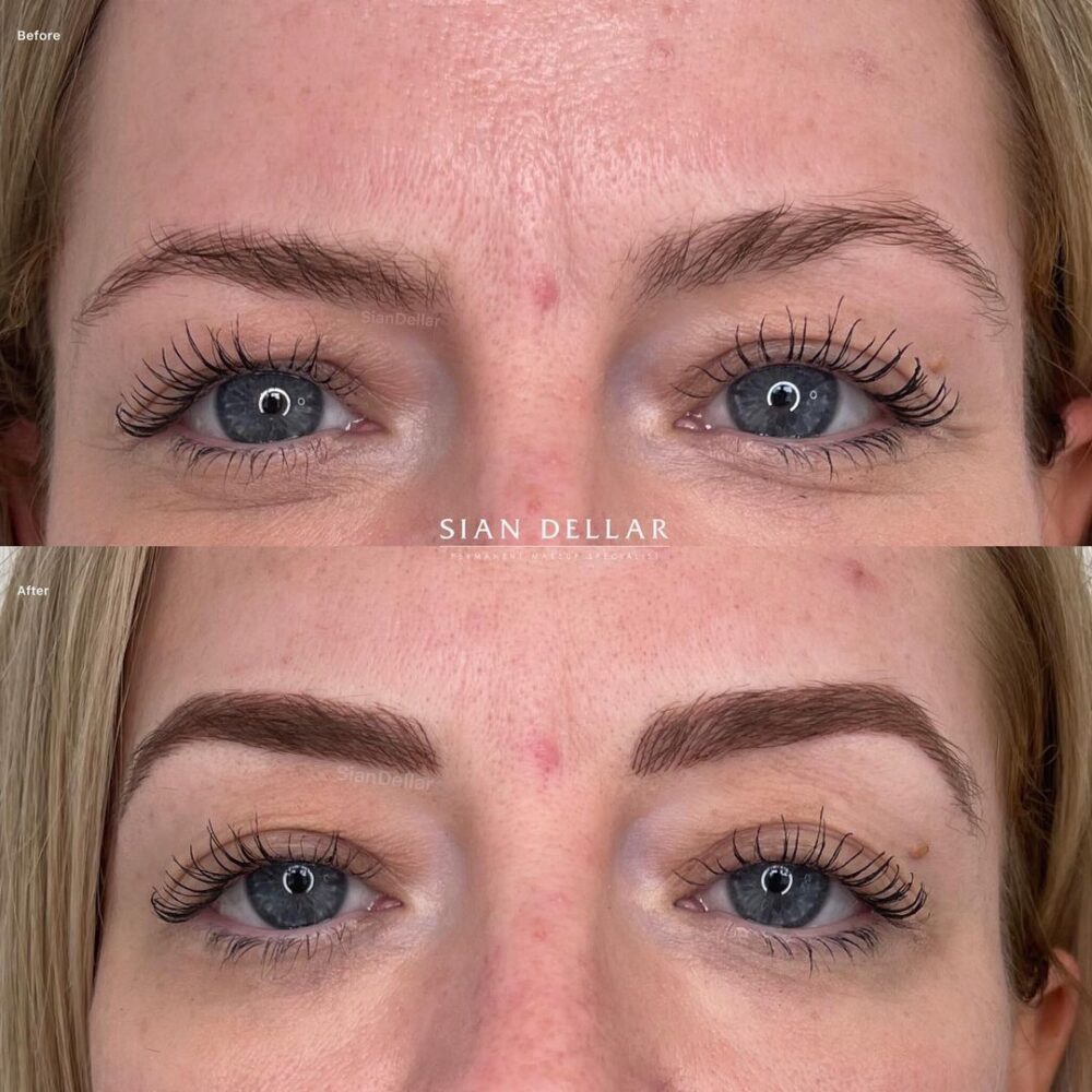 Perfecting unruly brows with microblading