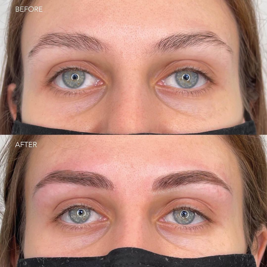 before and after of unruly brows