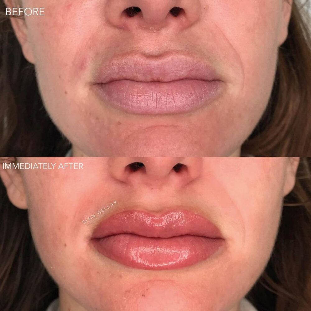 Semi permanent lip contour and full blush