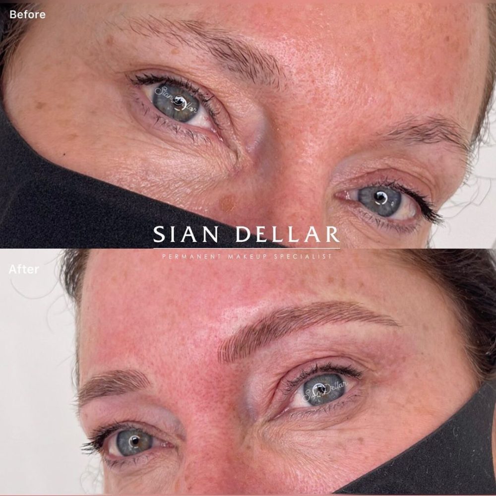 Microblading for brow reshaping and lengthening