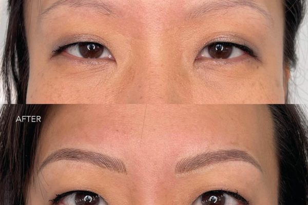 Transform thin, almost non existent brow hair to naturally looking thick ones