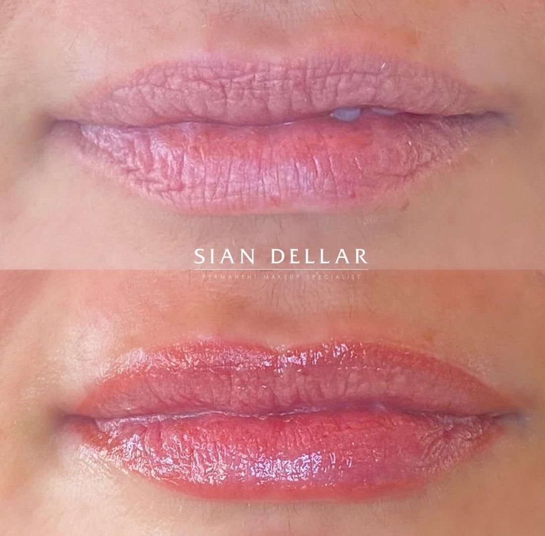 Lip blush treatment