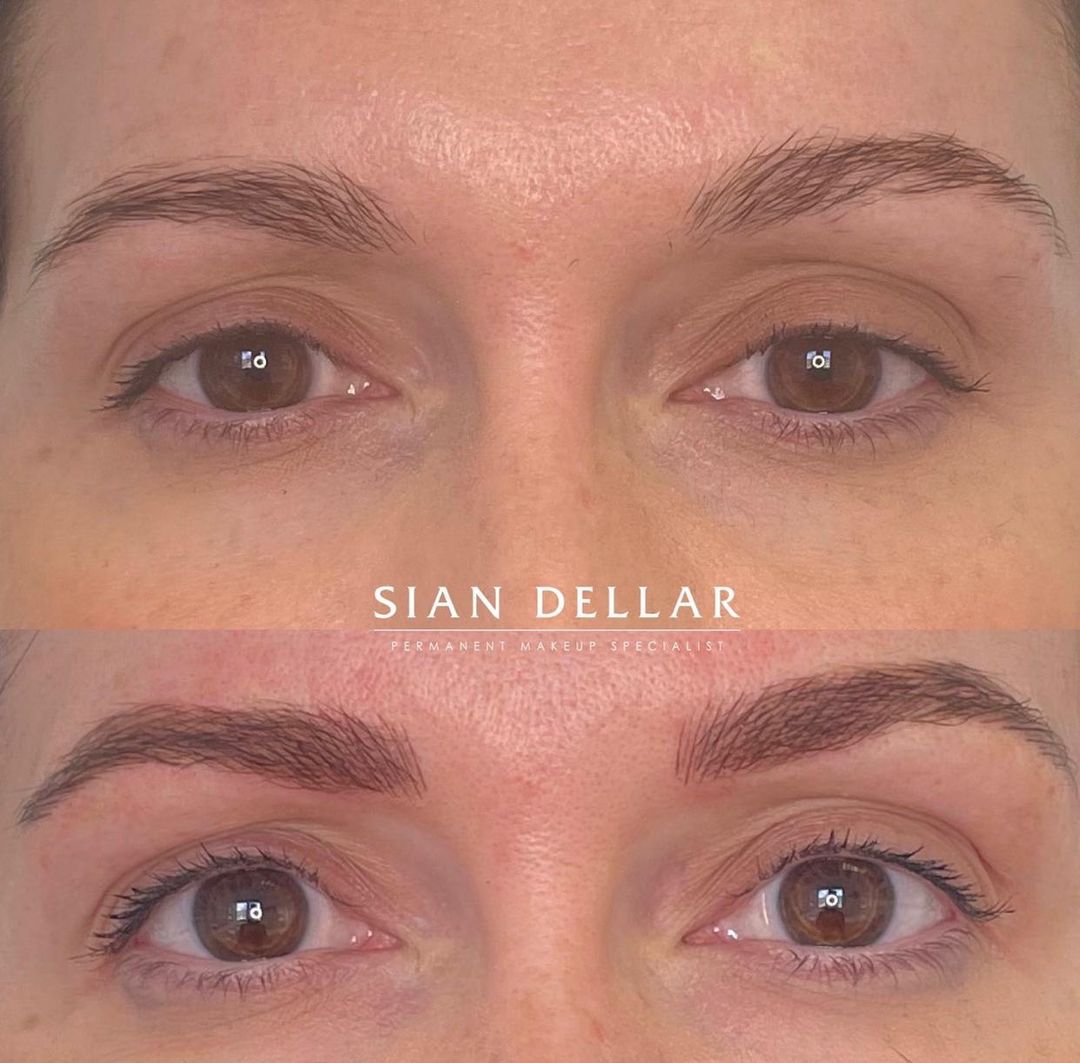 before and after of brow arch enhancement