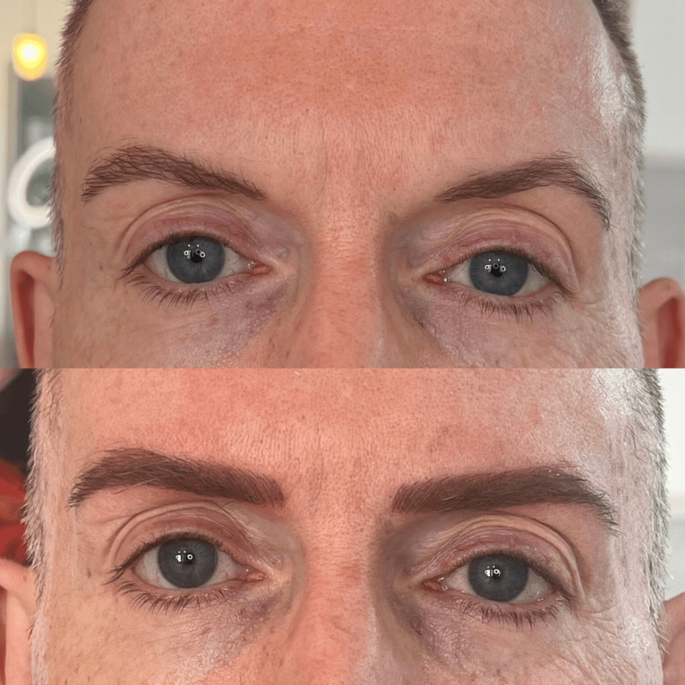 Enhancing facial features with combination brows for men