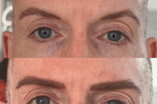 Enhancing facial features with combination brows for men
