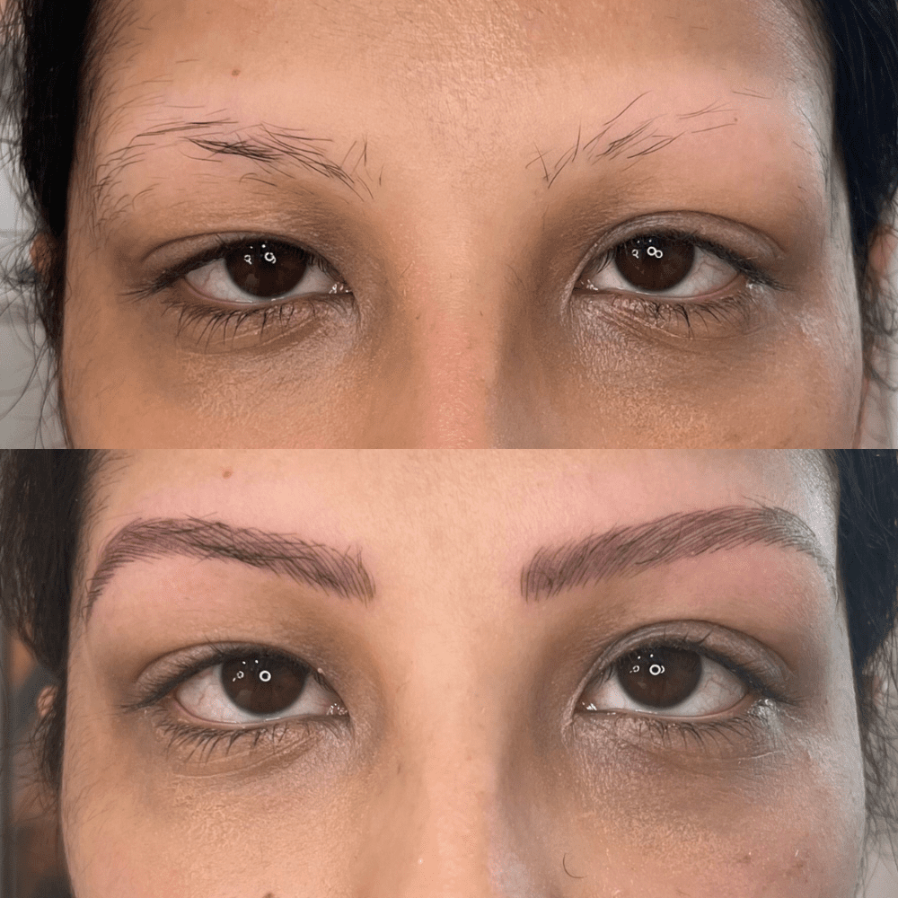 Combination brows for thinning or balding brows