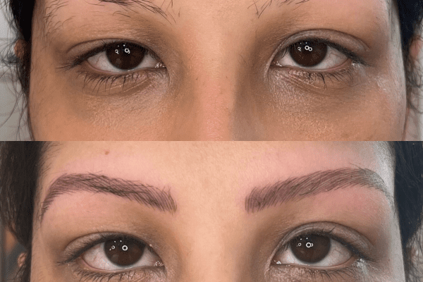 Combination brows for thinning or balding brows