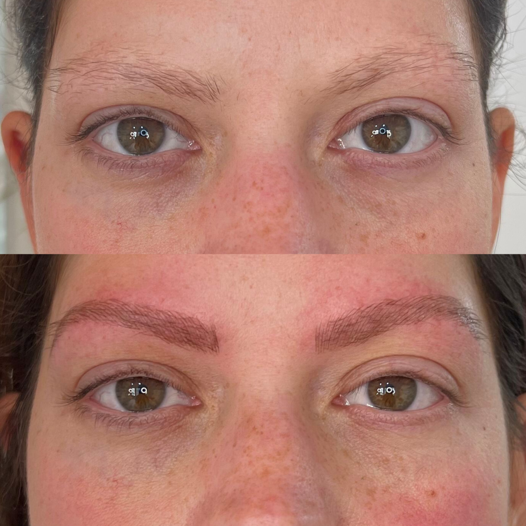 Before and after of combination brows procedure