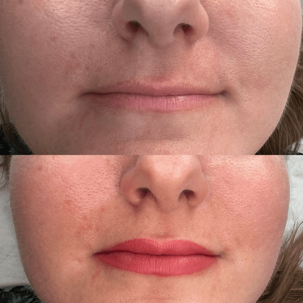 Lip Blush improves lip line and shape